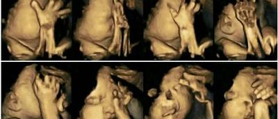 Des Images Choquantes Voici Le Corps D Un Bebe Dans Le Ventre D Une Fumeuse Photos Sudinfo Be