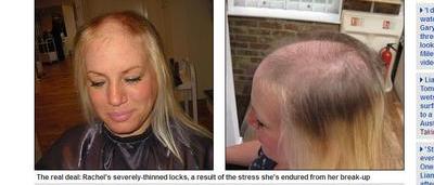 Rachel Brown Perd Ses Cheveux Suite A Une Rupture Sudinfo Be Rachel Brown Perd Ses Cheveux Suite A Une Rupture Sudinfo Be