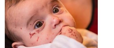 Un Bebe De 4 Mois Agresse Par Une Fillette De 7 Ans Le Nourrisson A Ete Griffe Et Mordu Sudinfo Be Un Bebe De 4 Mois Agresse Par Une Fillette De 7 Ans Le Nourrisson A Ete Griffe Et Mordu Sudinfo Be