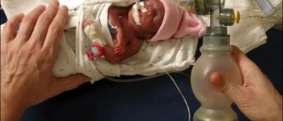 Les Parents D Un Grand Premature Ne Avec Seulement 900 Grammes Veulent Mettre Fin A L Acharnement Therapeutique Sudinfo Be