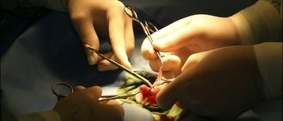 Lors D Une Circoncision Le Rabbin Coupe Le Penis Du Bebe De 8 Jours Sudinfo Be Lors D Une Circoncision Le Rabbin Coupe Le Penis Du Bebe De 8 Jours Sudinfo Be