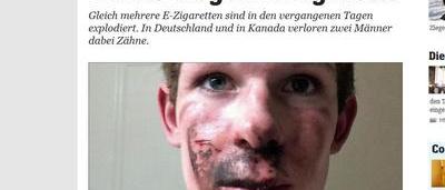 elfbar nachfüll pod läuft aus Une cigarette électronique explose au visage d'un jeune homme